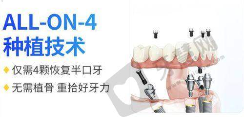 福州威斯登口腔门诊部的价格情况