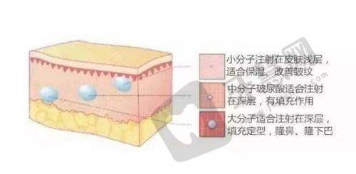 北京京城皮肤医院祛疤好吗?二氧化碳激光祛疤成效佳