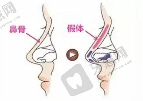 武汉韩辰医疗美容医院预约挂号方式: