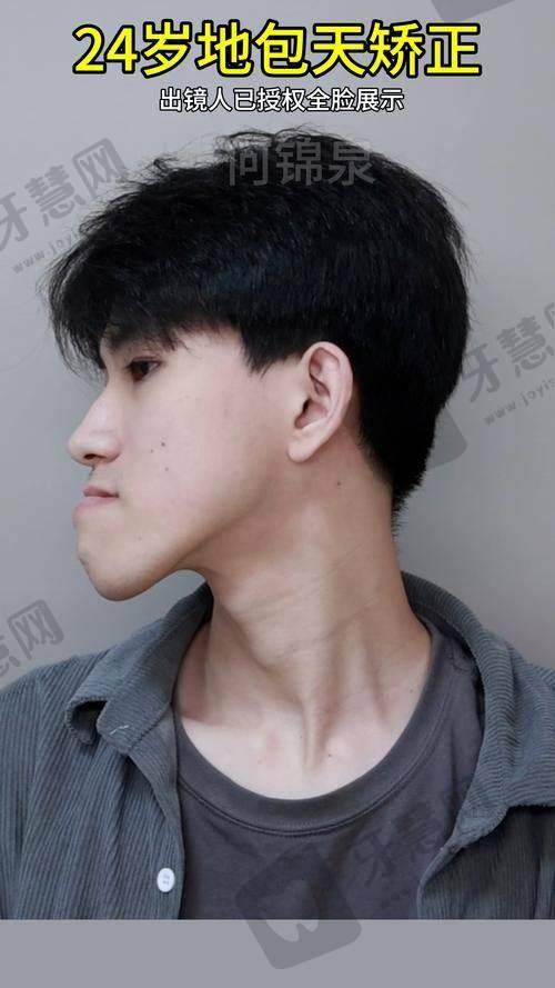 福州牙丽爱口腔门诊部价格表