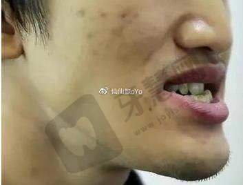 三、福州伽禾伽美医院口腔科怎么样,口碑评价如何?