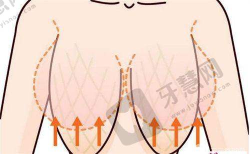 脱发打cgf多少钱一针?——注意事项