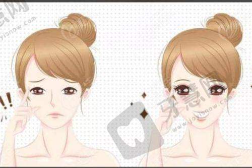 上海爱尔眼科医院服务体验优质贴心