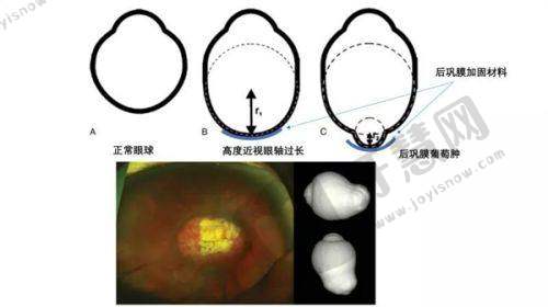 上海爱尔眼科医院收费标准透明合理
