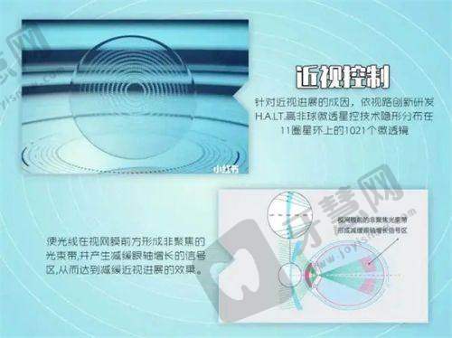 上海爱尔眼科医院医生简介:李霞