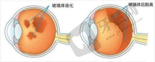 上海爱尔眼科医院如何进行在线预约