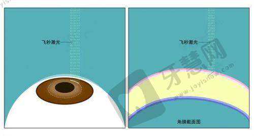 重庆大坪医院眼科挂号预约全攻略:真人实例分享