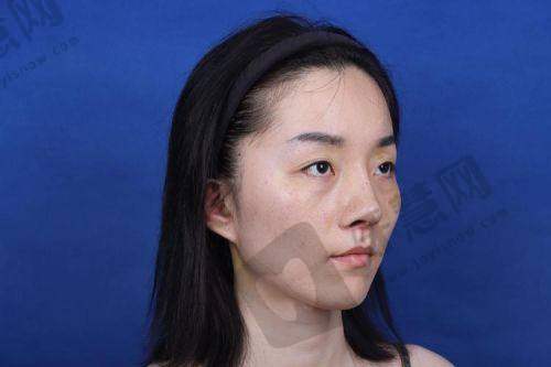 福州莳肌医疗美容诊所有哪些特色医疗美容项目