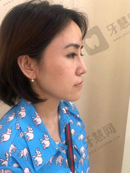 李花停医生坐诊医院