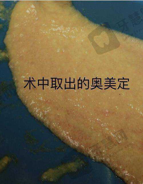 南方医 科 大学南方医院：清奥+修复“高能选手”！
