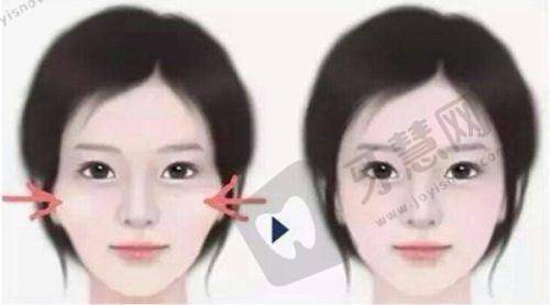 深圳婳美医疗美容医院收费价格表/收费标准