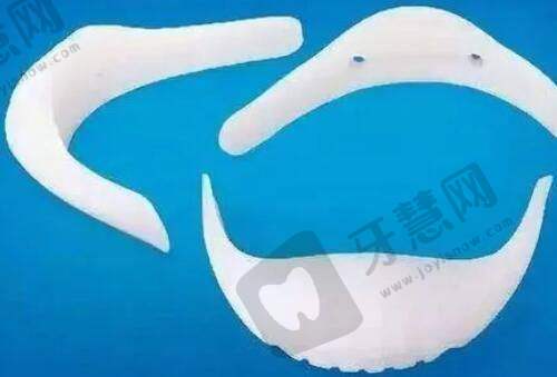 阴唇馒头型的好还是蝴蝶型的好看：实用体验差异