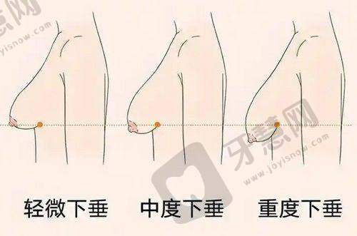 深圳鹏程男科医院怎么样:口碑良好患者认可