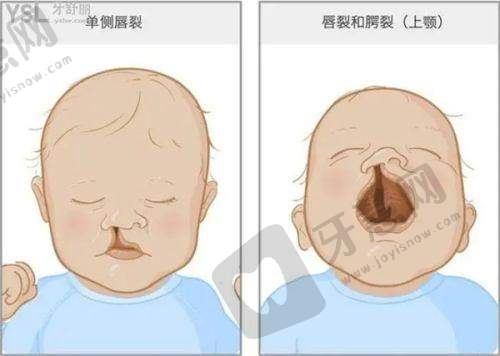为什么选择上海九院张如鸿医生？