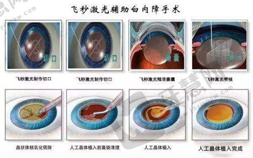 西 京医院整形项目实例及成效