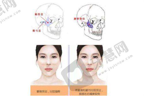 整形医生李信峰在哪个医院坐诊？深圳宝丽是执业地，鼻修复技术获好评