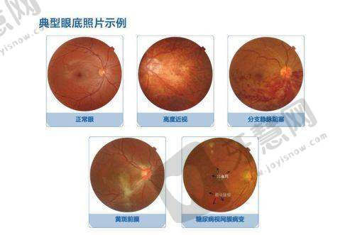 上海医大医院眼科特色项目及技术优势