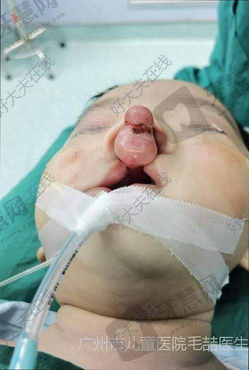 如何预约上海九院张如鸿医生？