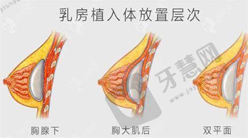 【沈阳名流整形医院是三甲医院吗】正规医美口碑好!医生做眼鼻胸吸脂技术强(附2025价格表)