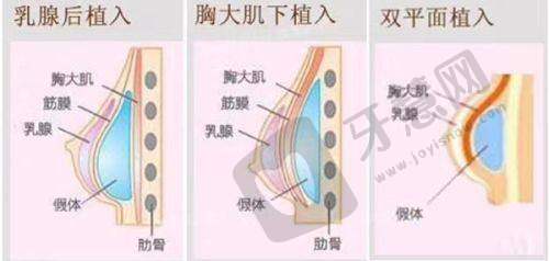 辽宁曙光整形外科医院正规吗?优势项目有哪些?眼鼻胸吸脂都是强项,这些“坑”它不踩