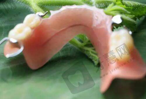 大连爱德丽格刘志刚修复双眼皮怎么样？看真人案例效果自然惊艳