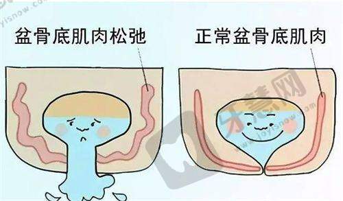 超声炮不同类型成效怎么样