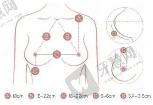 眼袋大怎么治疗成效至佳?不想开刀?5种非手术方法实测:哪些真有效,哪些是智商税?