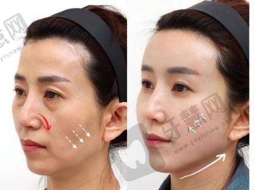 沈阳百嘉丽电话询问实例:3个真实故事,告诉你“电话询问有多重要”!