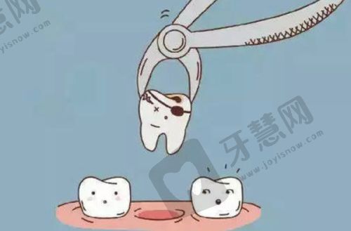 沈阳米兰口腔正规吗?技术优势有哪些?数字化种植+舒适化诊疗