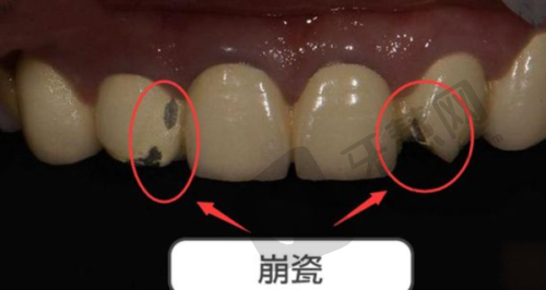深圳明森数智口腔门诊部真人口碑评价怎么样?