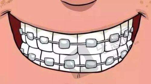 德韩口腔不同种植方式2025收费标准对比