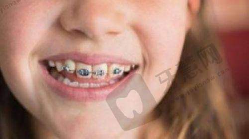 北京韩国登腾Dentium医院哪家好——北京启康口腔