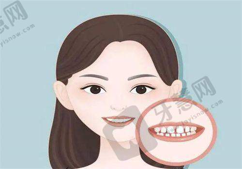 北京韩国登腾Dentium医院哪家好——北京极简海德堡口腔