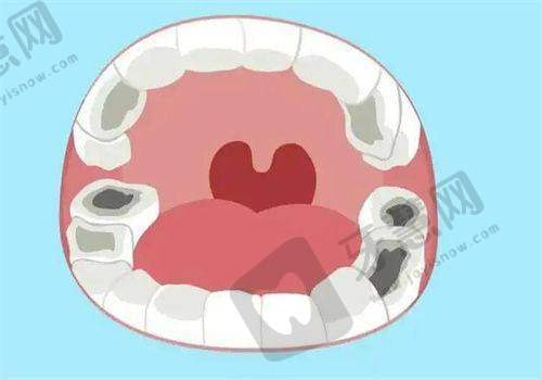 北京韩国登腾Dentium医院哪家好——北京牙元素口腔