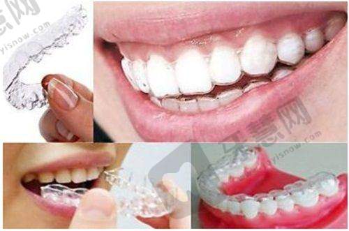 四医大口腔医院半口种植牙费用构成