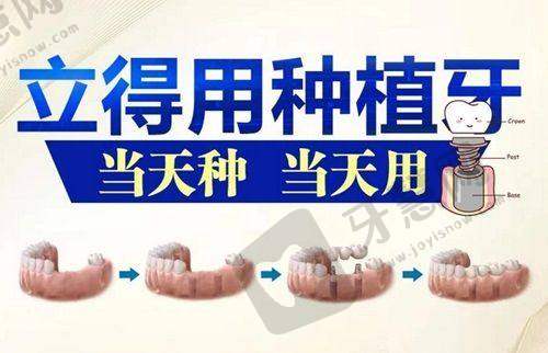 四医大口腔医院全口种植牙价格分析