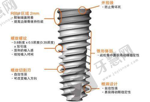 西安团圆口腔医院:数字化种植与矫正的优选