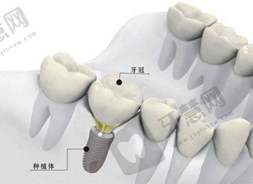 总结:沈阳全好口腔7家门店,总有一家在你身边!