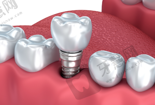 沈阳全好口腔还有几家?沈河区2家门店:核心商圈高端诊疗