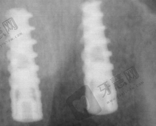 沈阳全好口腔还有几家?2025最新7家门店分布:和平/沈河/浑南等区域地址汇总