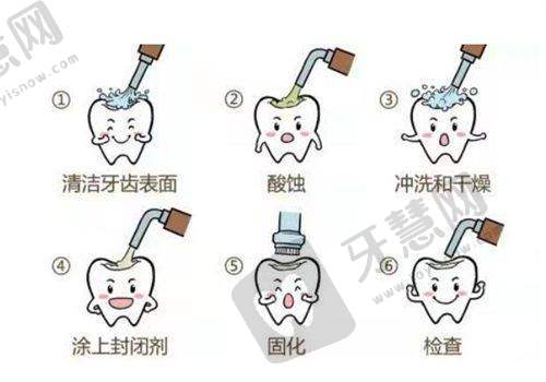 【沈阳欢乐口腔医院电话】2025最新！附地址+那桐医生预约方式|种植牙1980元起矫正8500元起（根管治疗380元起）