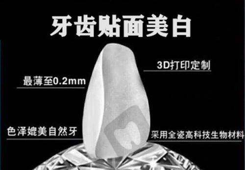 四医大口腔医院种植牙价格优化政策解读