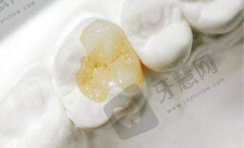 沈阳沈美口腔怎么样?(口碑好|治牙效果赞|种植牙技术强!2025价格表曝光:洗牙99元起|补牙299元起)