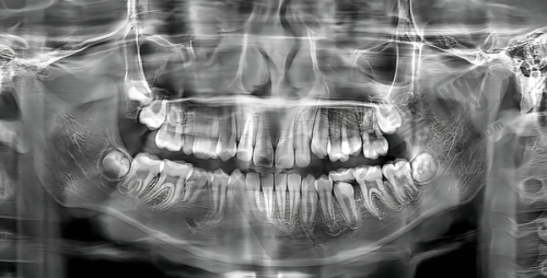 北京韩国登腾Dentium医院哪家好——北京伶俐口腔门诊部