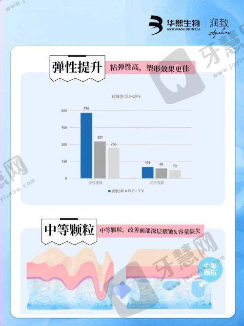 实例2:@琪琪(35岁,泪沟+眼袋选1.8万元眶隔释放)