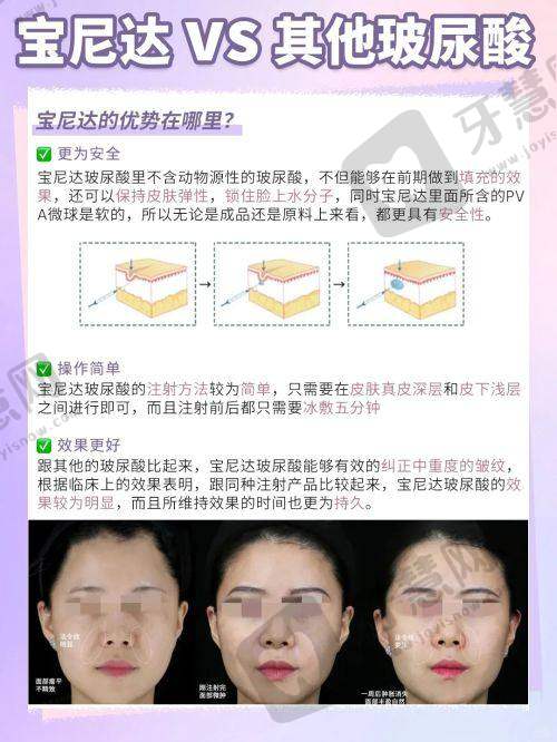 选择范荣杰手术的优势亮点