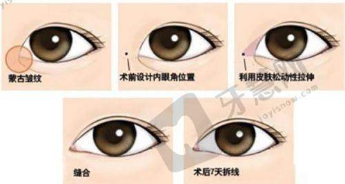 二、眼袋怎么消除简单方法:日常护理篇(每天5分钟,预防眼袋找上门)