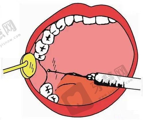 上脸下垂修复手术怎么做:成效能维持多久?2个实例告诉你真相