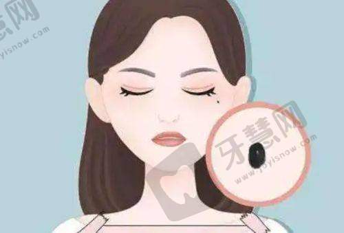 总结:多层双眼皮如何改善?选对技术+医生,3个月重现灵动双眼!