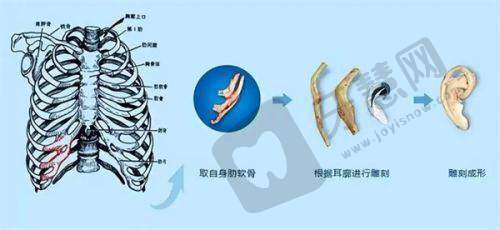 李秋怿医生擅长项目